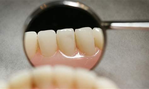 خطأ شائع يؤدي إلى اصفرار الأسنان..ما هو؟